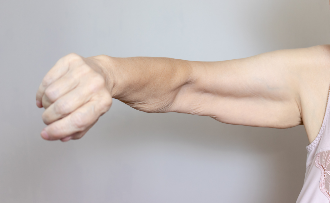 How to Protect Muscle While Losing Weight on GLP-1